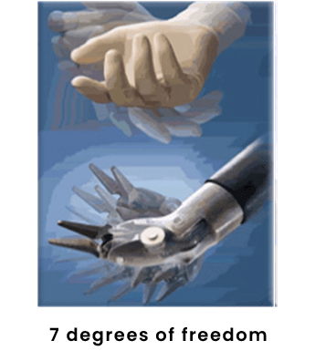 7 Degrees of Freedom